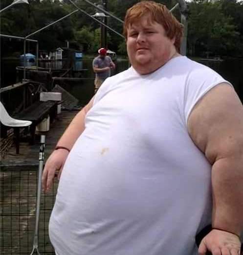 世界上最胖的人,常年赤裸在家,依靠父亲照顾起居!坦言不会减肥